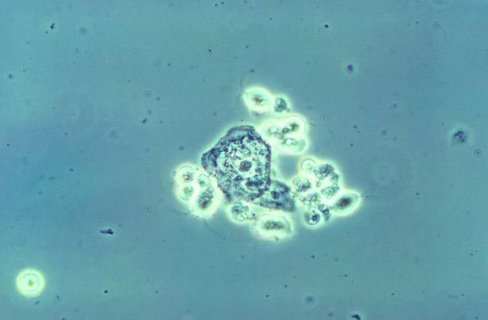 Microscopic Image of Trichomoniasis, an STI.